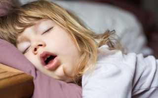 Храп у ребенка во сне — причины возникновения, отличие от сопения и диагностика