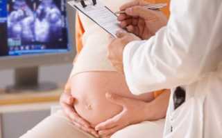 Бесплатные роды или роды по контракту, что предпочесть