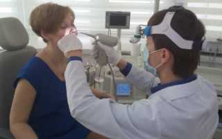 Удаление гланд лазером у взрослых и детей