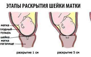 Зачем нужна биометрия шейки матки?