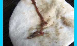 Мазня вместо месячных: беременность ли это