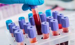 Генерализованный зуд — причины возникновения и сопутствующие симптомы