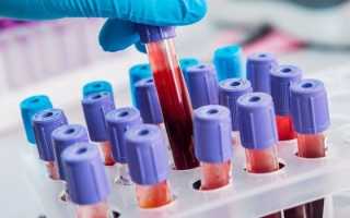 Генерализованный зуд — причины возникновения и сопутствующие симптомы