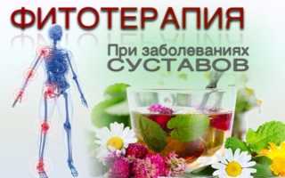 Как лечить суставы в домашних условиях быстро и эффективно — полная подборка самых лучших товаров для лечения дома