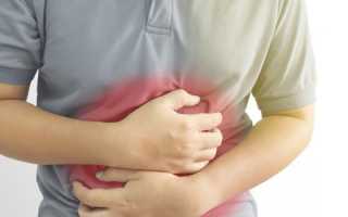 Обострение язвы желудка — причины, симптомы и лечение