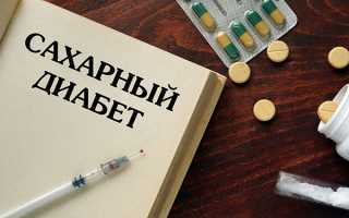 Глюкозотолерантный тест при беременности