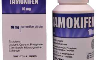 Гиперплазия эндометрия как причина развития рака эндометрия на фоне приема тамоксифена