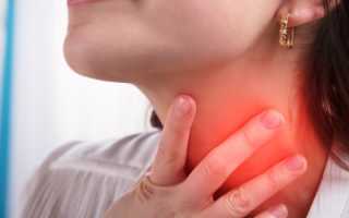 Почему болит горло