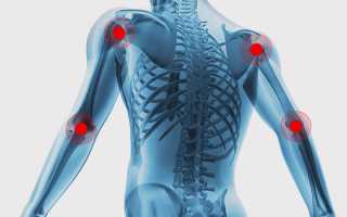 Хрустят суставы по всему телу