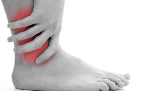 Васкулит – что это, причины, симптомы и лечение заболевания