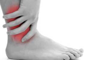 Васкулит – что это, причины, симптомы и лечение заболевания