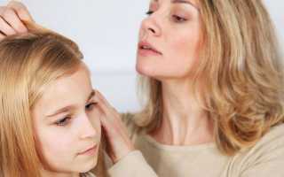 Гниды на волосах у человека