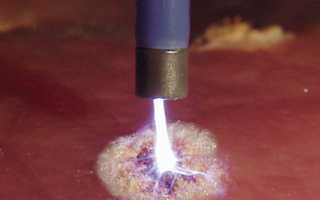 Что такое аргоноплазменная коагуляция шейки матки?