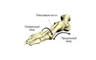 Какие причины приводят к возникновению плоскостопия у детей, подростков и взрослых