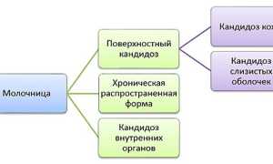 Кандидоз – симптомы и лечение у женщин, мужчин, детей