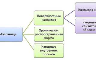 Кандидоз – симптомы и лечение у женщин, мужчин, детей