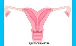 Седловидная матка: беременность и роды