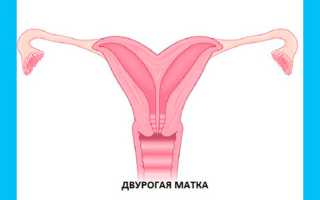 Седловидная матка: беременность и роды