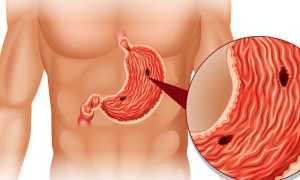 Ундевит – инструкция по применению и показания для детей и взрослых, состав, дозировка, форма выпуска и цена