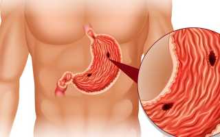 Ундевит – инструкция по применению и показания для детей и взрослых, состав, дозировка, форма выпуска и цена