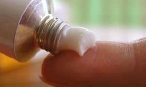 Эффективная мазь Лоринден С для лечения грибка