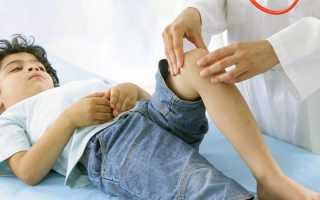 Лечение артрита у детей — медикаментозные и народные средства, физиотерапия и упражнения