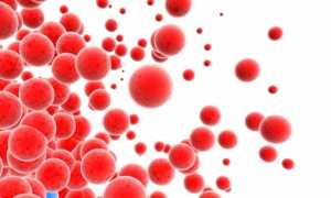 Миеломная болезнь