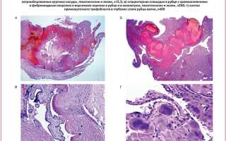 Как проводится гистология матки?