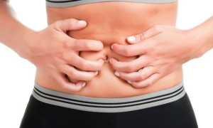 Язвенный колит