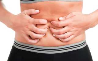 Язвенный колит