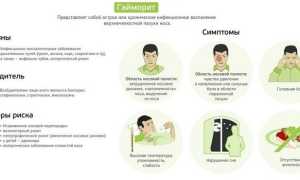 Признаки гайморита у взрослых и первые симптомы