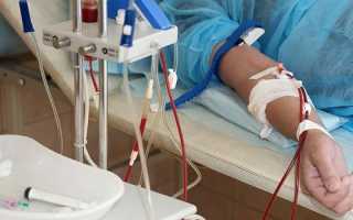 Плазмаферез  — показания и методы проведения процедуры, противопоказания и стоимость