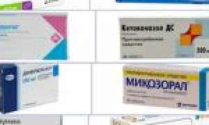 Принципы эффективного лечения молочницы у женщин