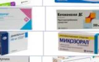 Принципы эффективного лечения молочницы у женщин