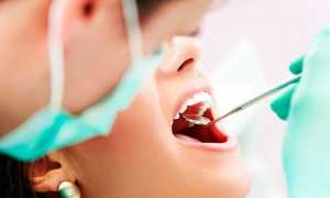 Коронка на зуб — виды и способы установки, показания к протезированию