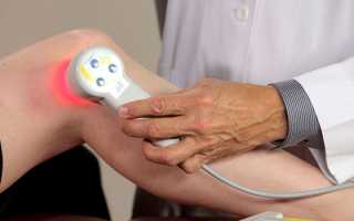 Лазеротерапия при артрозе коленного сустава