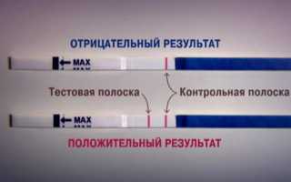 Как проходит подготовка к прижиганию эрозии шейки матки?