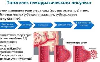 Основные причины возникновения инсульта у взрослых и детей