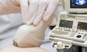 Лактостаз у кормящей мамы