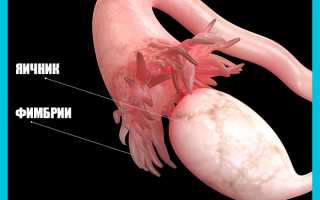 Действительно ли можно забеременеть при гидросальпинксе