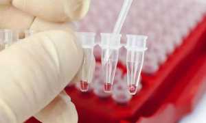 Тиреоглобулин — что это такое, показания к проведению диагностики, факторы и причины повышения