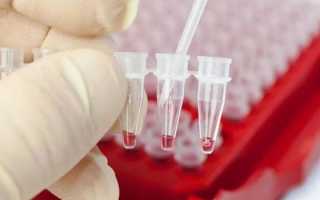 Тиреоглобулин — что это такое, показания к проведению диагностики, факторы и причины повышения