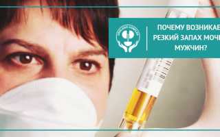 Неприятный запах мочи у мужчин