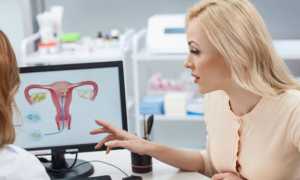 Киста яичника во время беременности