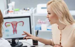 Киста яичника во время беременности