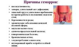 Внутренний геморрой у женщин и мужчин — симптомы и лечение