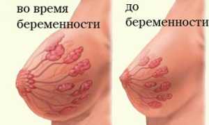 Когда начинает болеть грудь при беременности