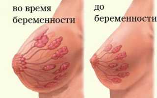 Когда начинает болеть грудь при беременности