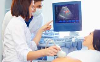 Что такое допплерометрия сосудов матки: кому ее назначают?