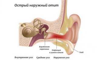 Последствия отита у взрослых — причины развития и список осложнений